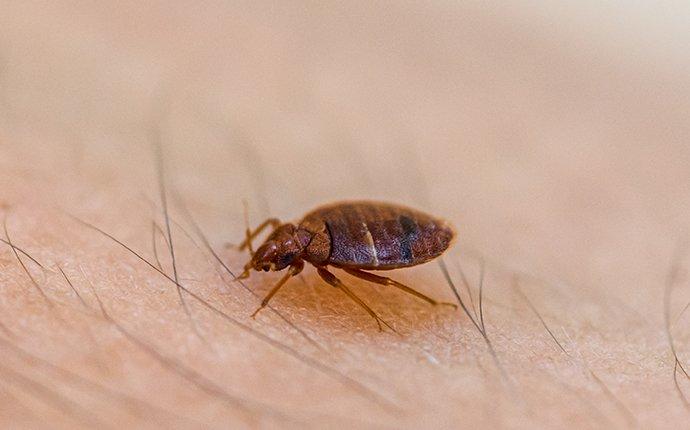 a bed bug biting skin in old bridge township