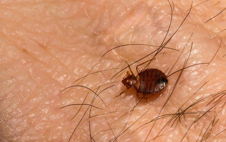 a bed bug on someones skin
