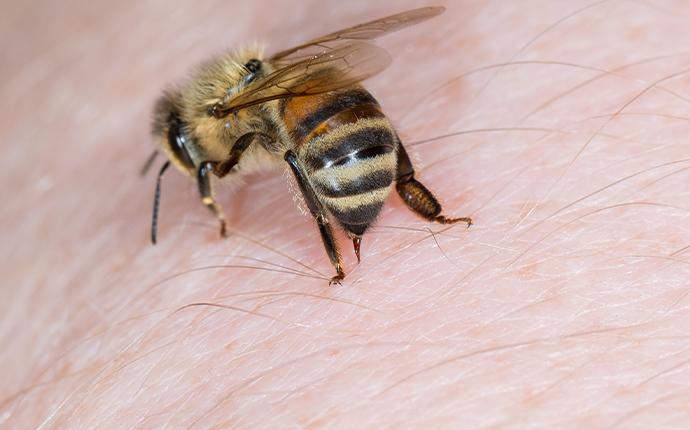 a bee stinging a persons skin