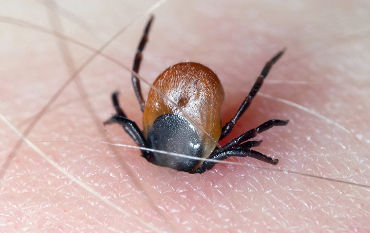 a tick embedded in a persons skin