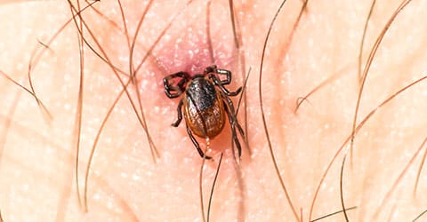 a tick biting a persons arm at their home in mendota illinois