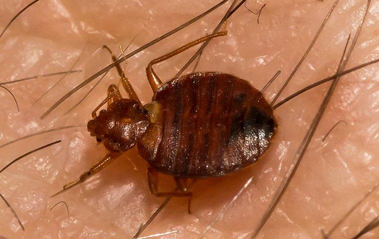 a bed bug biting a persons skin
