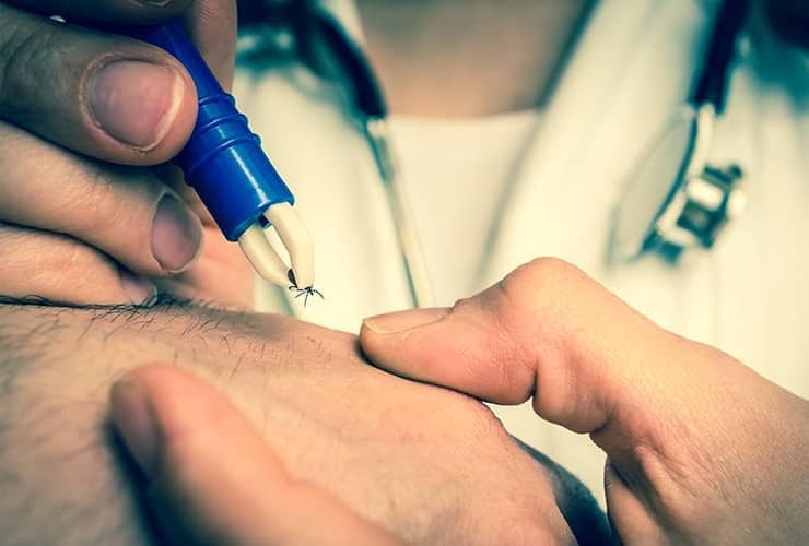 Learn More About How Serious Lyme Disease Is doctor removes tick with tweasers