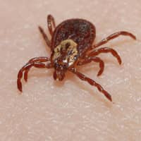 Deer Tick On Skin