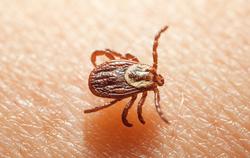 a tick crawling on human skin