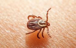 a tick crawling on human skin