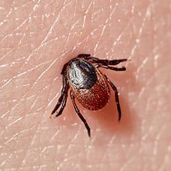 an engorged tick with its head fully embedded in a hartford connecticut  residents bare skin