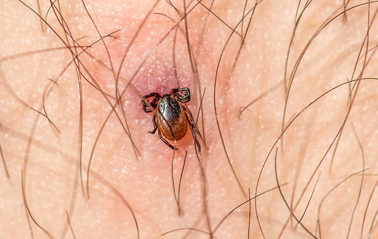 a tick biting a persons arm