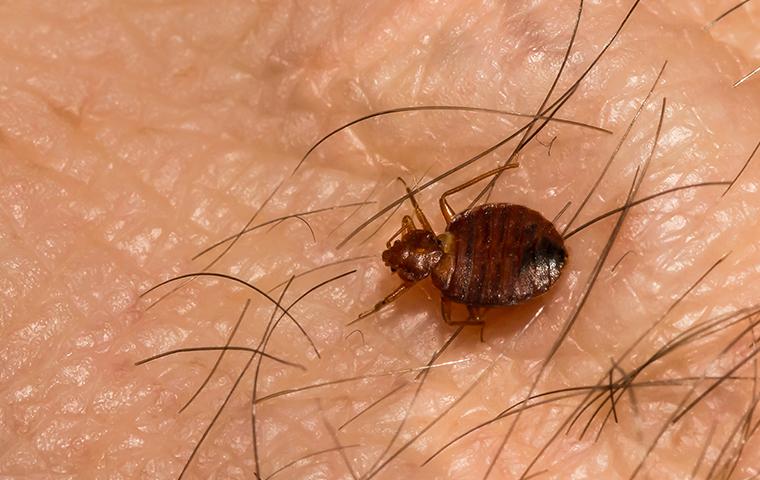 a bed bug on skin