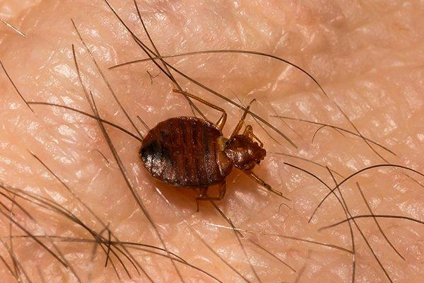 a bed bug crawling and biting human skin