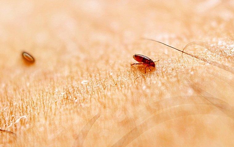 fleas on person's skin