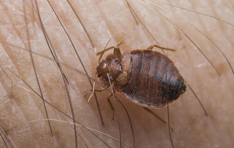 a bed bug crawling on a persons leg