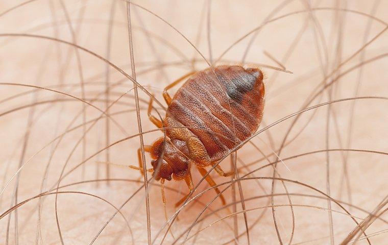 a bed bug biting the skin of a resident of sawgrass florida