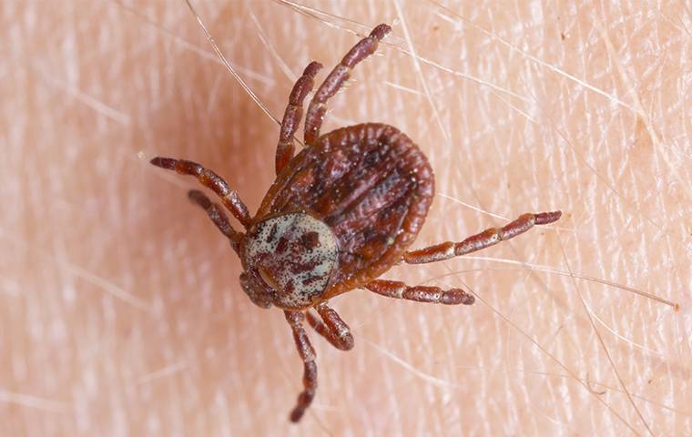 a dog tick biting human skin