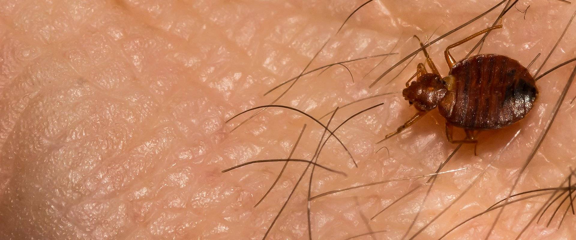 bed bug on skin