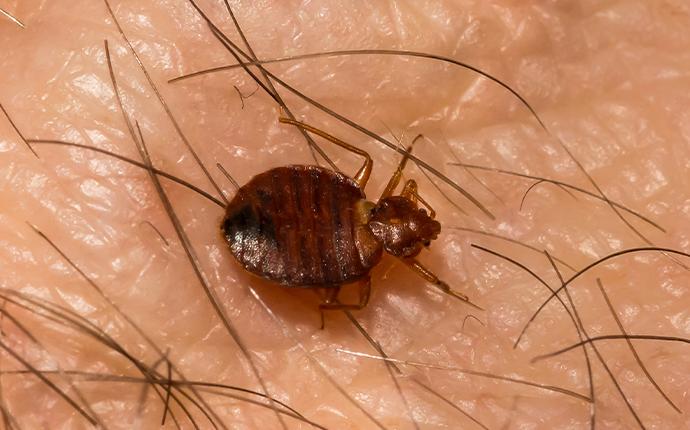 bedbug on human skin