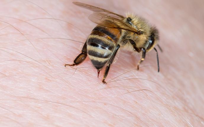 a bee stinging the skin