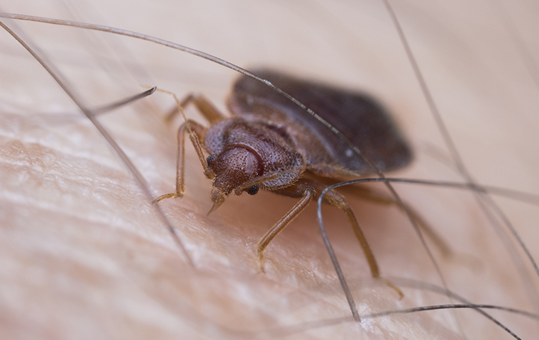 a bed bug on a persons head in chester county