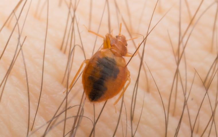 a bed bug infestation on the hairy skin of a Montgomery county resident