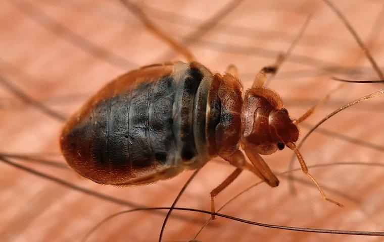 a bed bug in human hair
