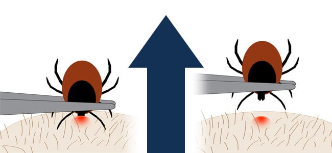 Graphic displaying how to remove a tick from skin