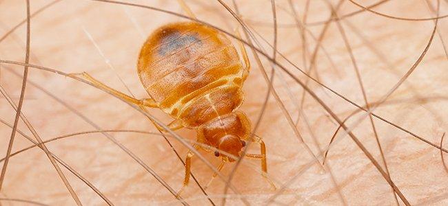 bed bug biting skin