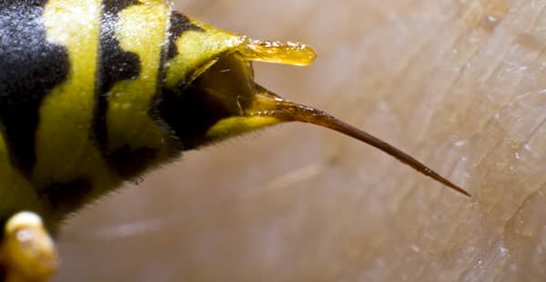 a bee stinger up close on a human resident of beverly beach maryland