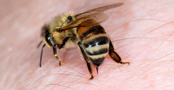 a honey bee stinging the hand of a resident in aspen hill maryland