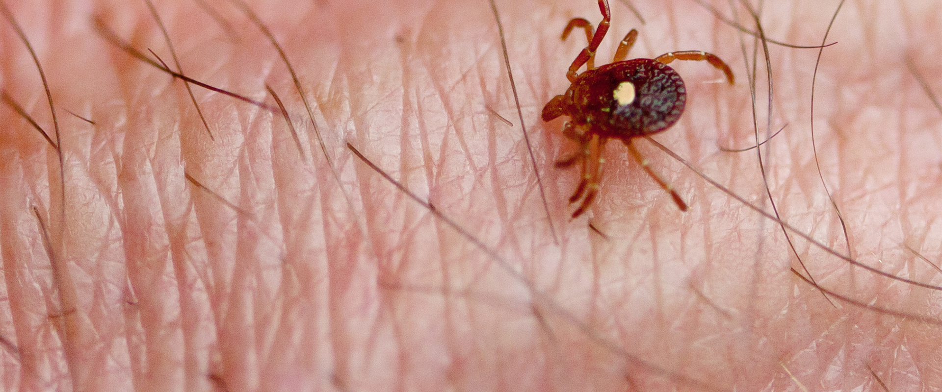 virginia woman with a lone star tick crawling on her arm