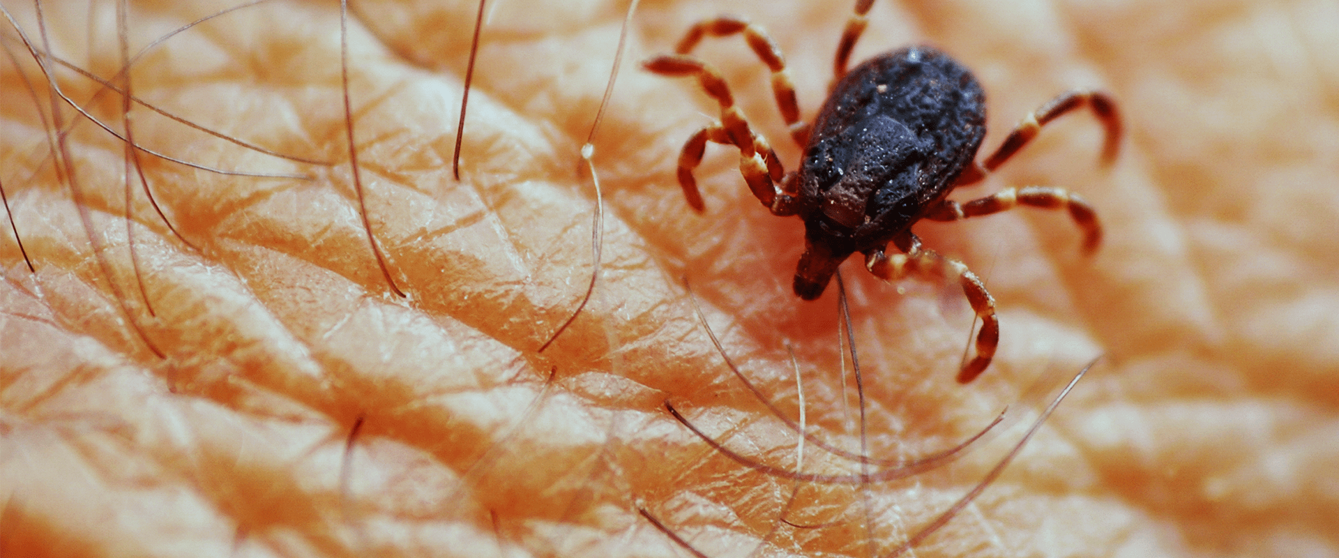 washington dc man with a tick in his hand