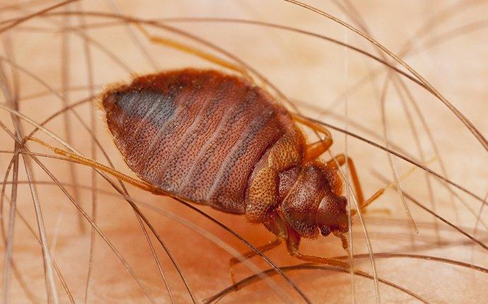 bed bug biting skin