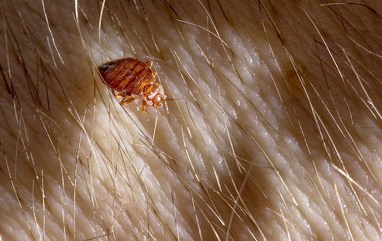 a bed bug on human skin