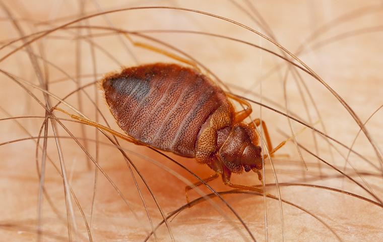 bed bug biting the skin of a washington dc resident