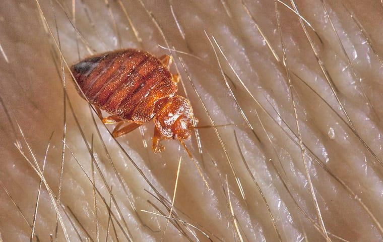 a full grown adult bed bug crawling through the hairy skin on a new jersey resident
