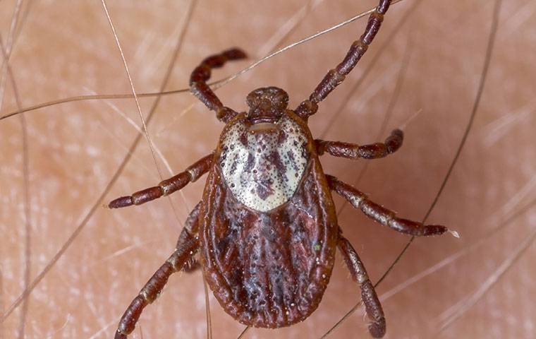 up close of an american dog tick on a persons leg