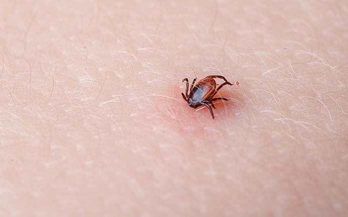 a tick embedded in a south carolina residents skin