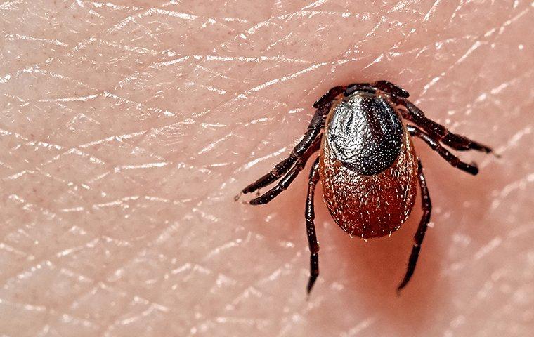 tick in skin