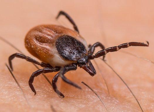 a black legged tick on a persons skin