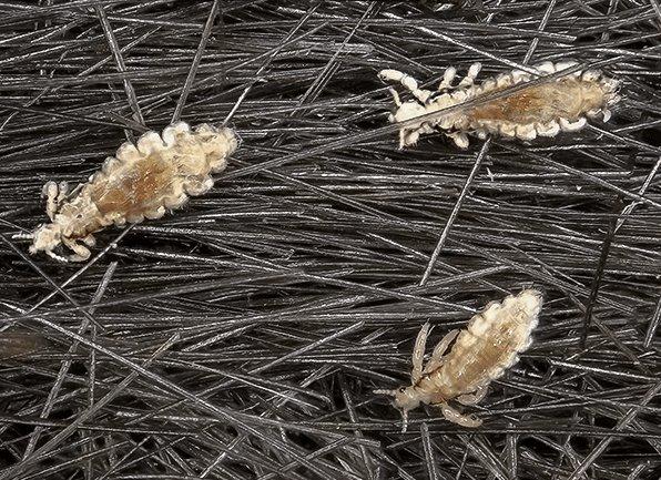 several head lice crawling around in the hair of a local homeowner in avon indiana