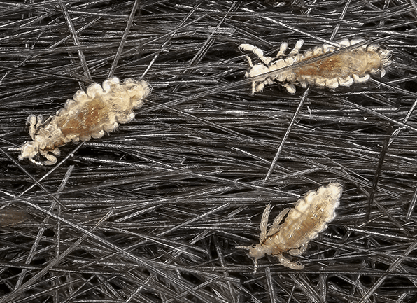 Take A Closer Look At Head Lice several head lice crawling around in the hair of a local homeowner in avon indiana