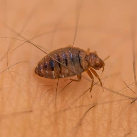 bed bug on a man in worcester ma