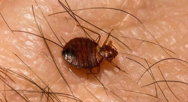A bed bug on someone's skin.