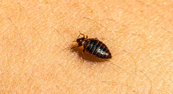 a bed bug crawling on human skin