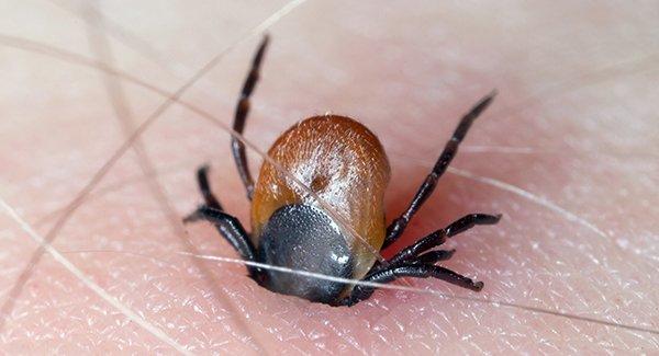 deer tick embedded in the skin of an arm