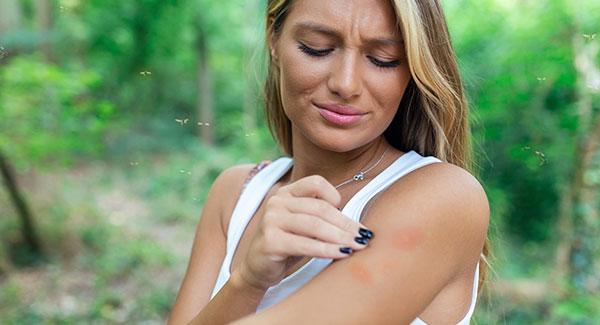 person looking at mosquito bites