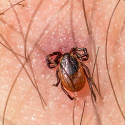 embedded tick