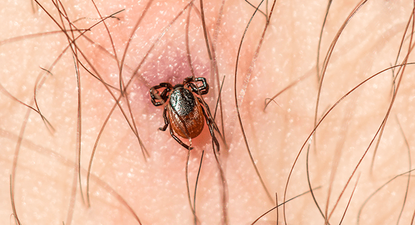 embedded tick