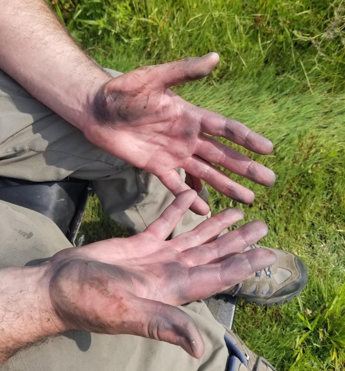 Enock's hands after pushing without gloves. Photo credit: Enock Glidden