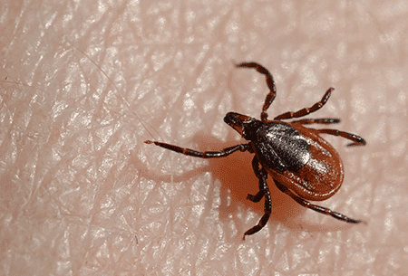 tick infestation human skin