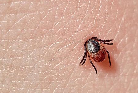 tick burrowing into skin